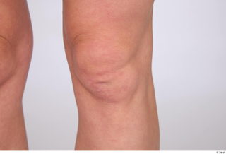 Riva knee 0003.jpg